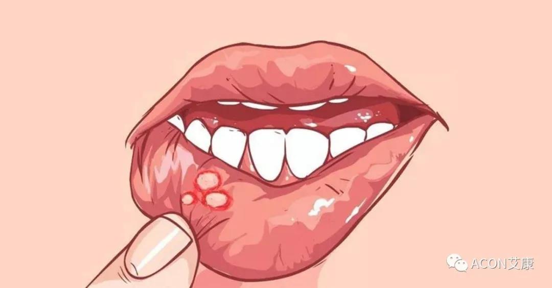 哪些小病容易讓人忽視，最后造成越拖越嚴(yán)重呢？