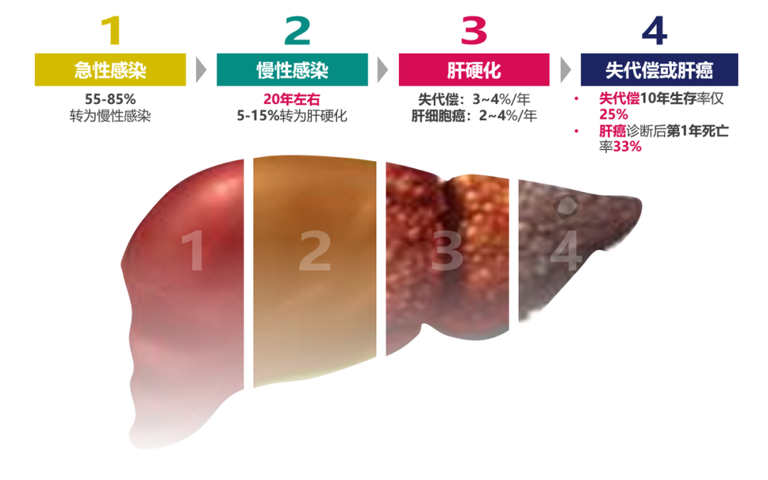 悄悄變成肝硬化、肝癌，很多人感染了卻不知道