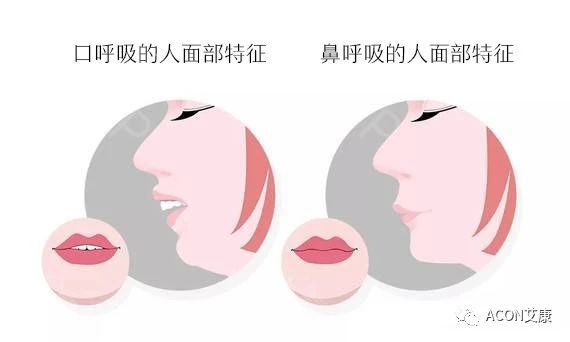 過敏性鼻炎會讓孩子變傻？！家長該如何應(yīng)對